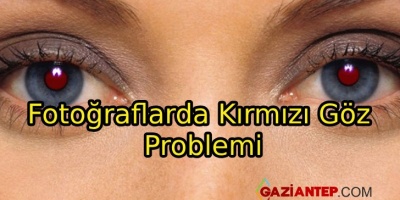 Fotoğraflarda Kırmızı Göz Problemi