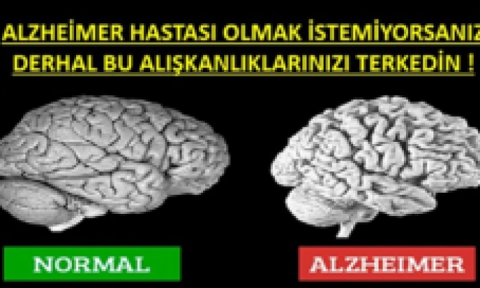 Alzheimer Olmak İstemiyorsanız Bırakın…