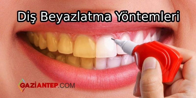 Diş Beyazlatmak İçin Doğal Yöntemler